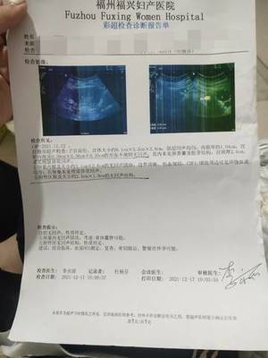 五周左右宮內(nèi)看不到卵黃囊是太早了還是宮外孕?