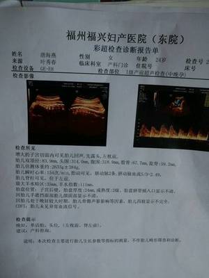 37周雙頂徑83醫(yī)生說(shuō)可能小腦畸形