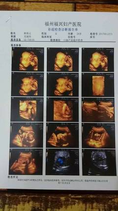 四維通過(guò)啦