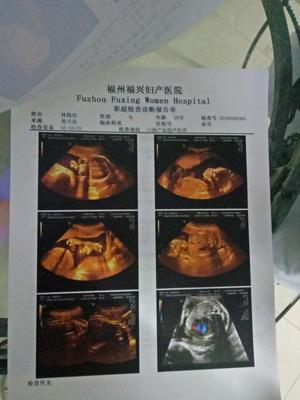 求大家?guī)兔聪履信?6個(gè)月半了