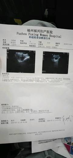 6+2的B超報(bào)告