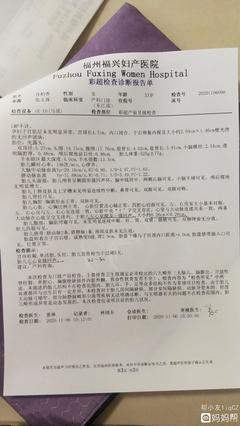 今天去照了四維,醫(yī)生說沒啥問題,劃線的地