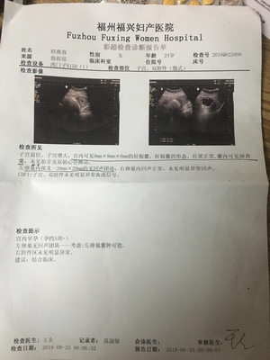 是不是太早了,所以還看不到胎芽跟胎心啊,擔(dān)心