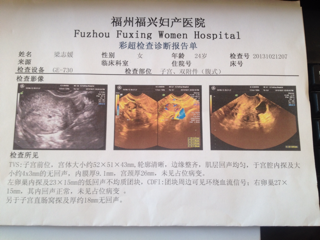 B超圖誰(shuí)會(huì)看的?為什么沒有回應(yīng)