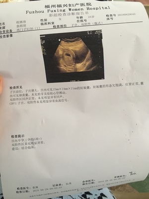 好擔(dān)心。怎么辦