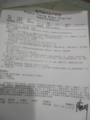 很好奇寶寶是男是女