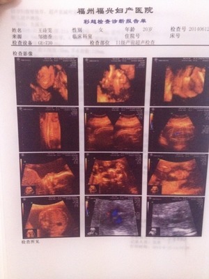 福州媽媽圈熱議 看看是男是女，福興婦產(chǎn)醫(yī)院的科學性別鑒定指南