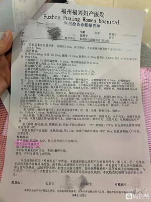 四維彩超遇小波折 福州福興婦產(chǎn)醫(yī)院經(jīng)歷分享與應(yīng)對(duì)建議